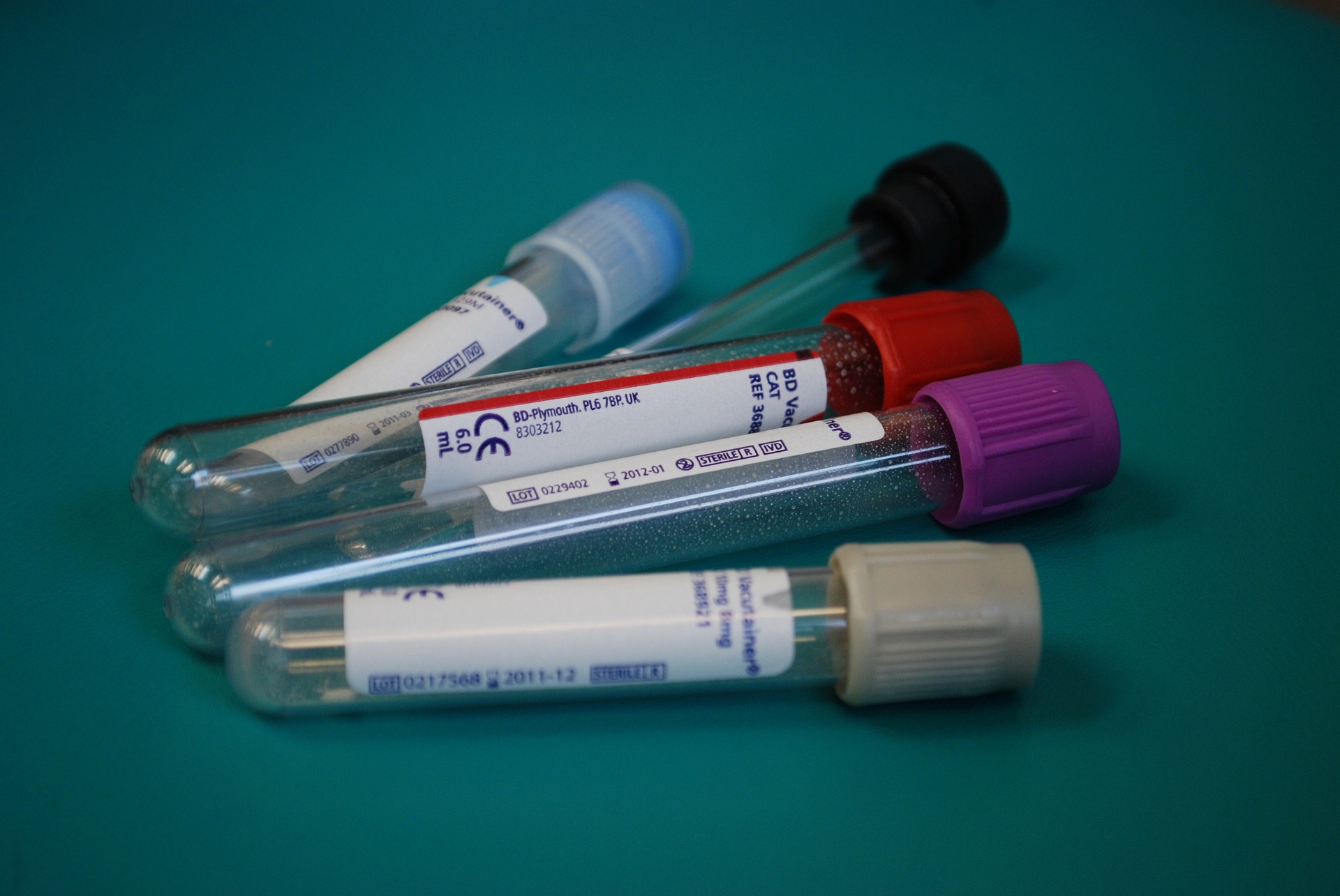 Rapid HIV Test – The Analysis of the Product