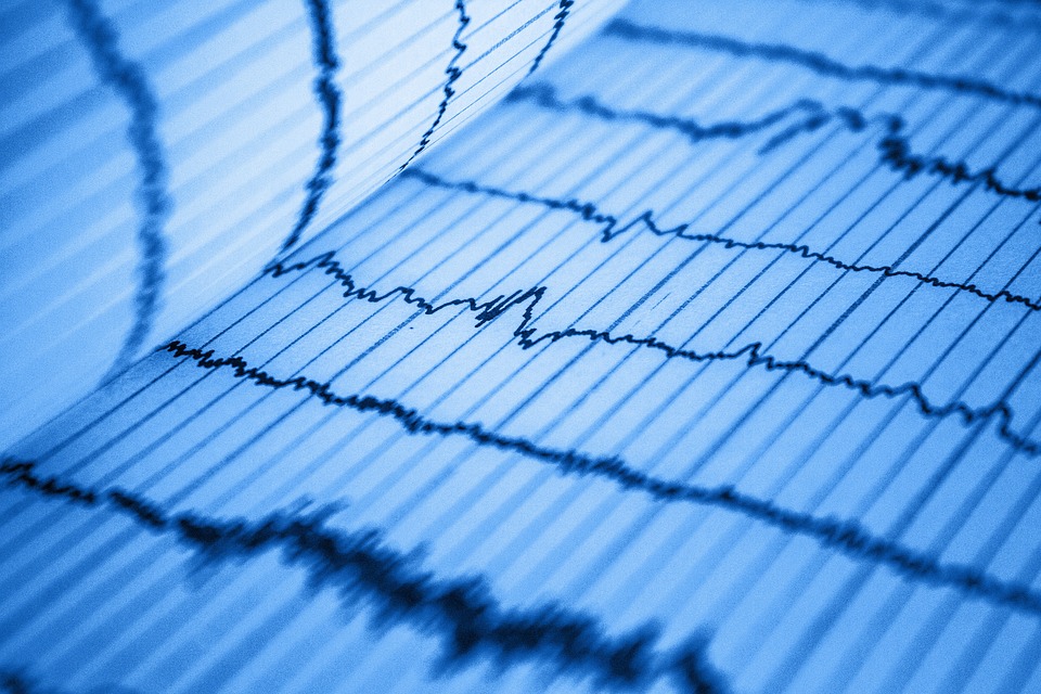 Understanding Prolonged PR Interval