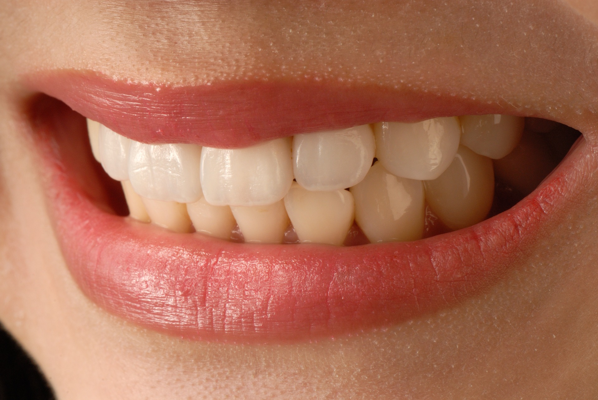 Understanding Teeth Veneers Price