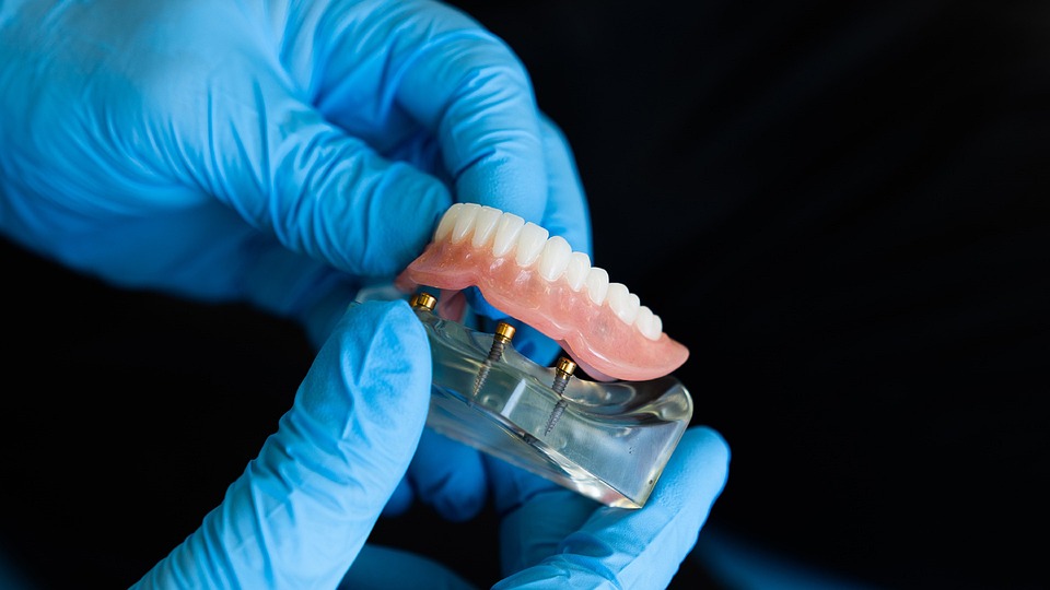 Getting Yourself a Brand-New Smile with Dental Implants