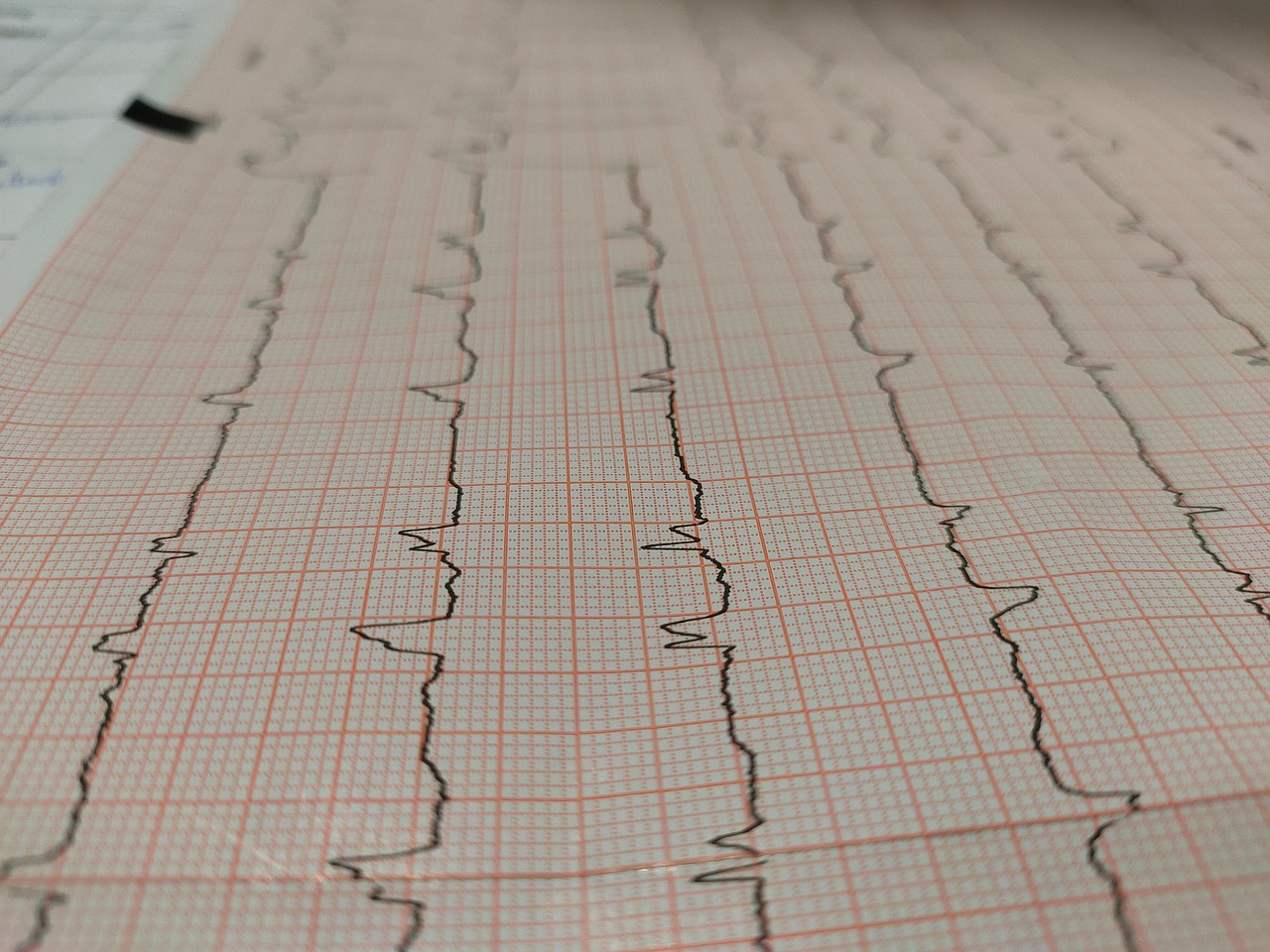 electrocardiogram-6821777_1280